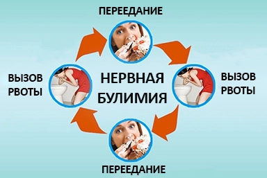 Лечение булимии в Кытманово